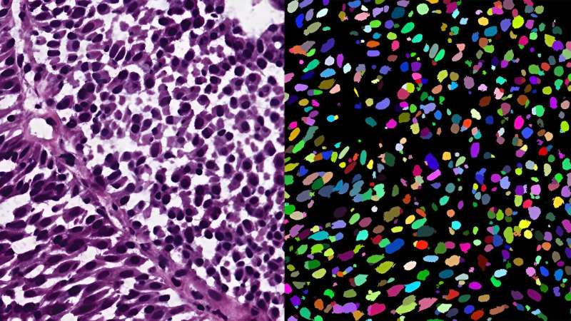 Microscopy image segmentation via point and shape regularized data synthesis