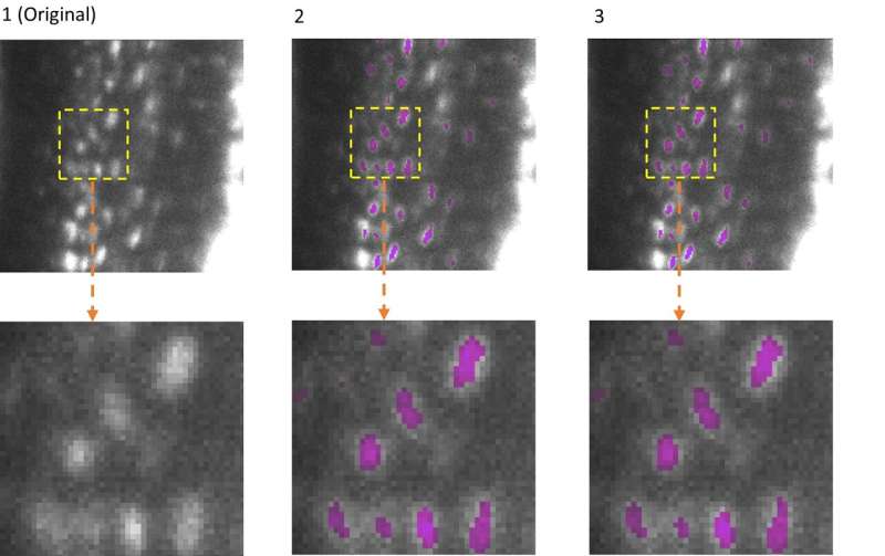 Analyzing microscopic images: New open-source software makes AI models lighter, greener