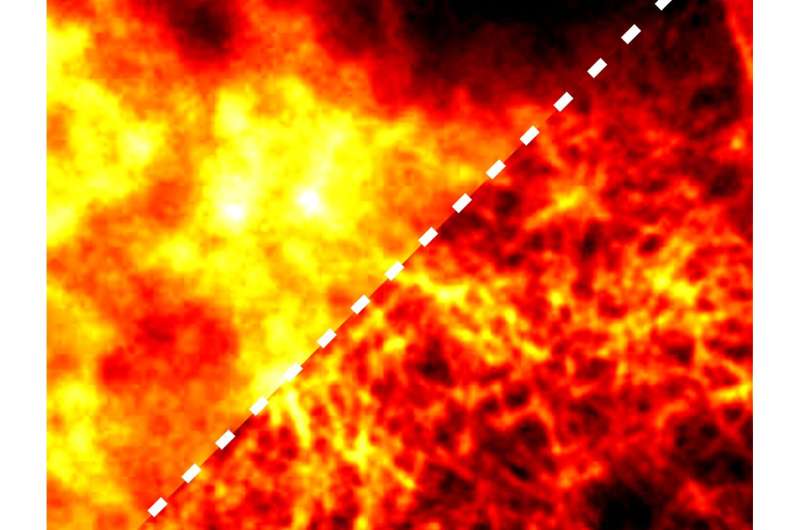 Artificial intelligence boosts super-resolution microscopy