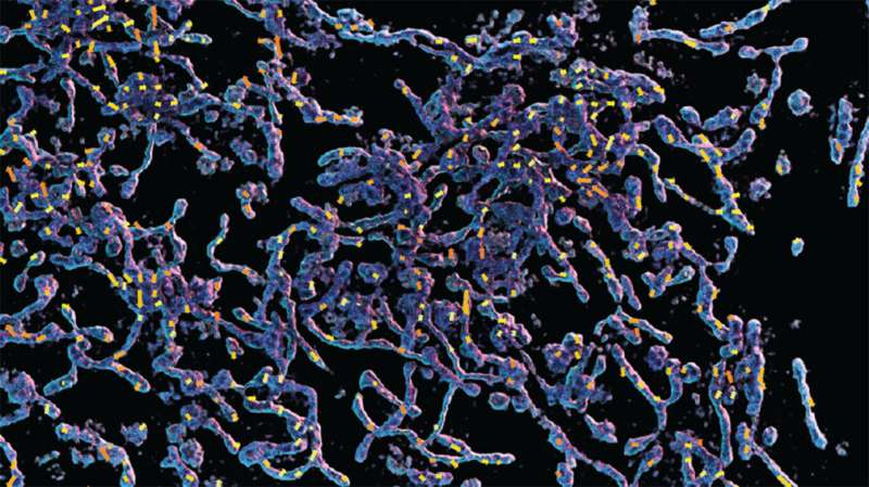 Bringing clarity to microscopic imaging: New tool removes motion artifacts